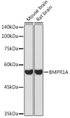 Anti-BMPR1A antibody used in Western Blot (WB). GTX55540