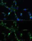 Anti-BUB1B antibody used in Immunocytochemistry/ Immunofluorescence (ICC/IF). GTX55541