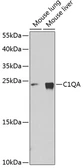 Anti-C1qA antibody used in Western Blot (WB). GTX55543