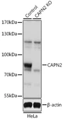 Anti-Calpain 2 antibody used in Western Blot (WB). GTX55545