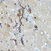 Anti-Calpain 2 antibody used in Immunocytochemistry/ Immunofluorescence (ICC/IF). GTX55545