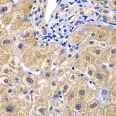Anti-CARD11 antibody used in IHC (Paraffin sections) (IHC-P). GTX55548