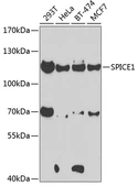 Anti-CCDC52 antibody used in Western Blot (WB). GTX55552