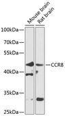 Anti-CCR8 antibody used in Western Blot (WB). GTX55553