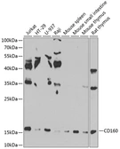 Anti-CD160 antibody used in Western Blot (WB). GTX55554
