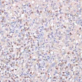 Anti-CD82 antibody used in IHC (Paraffin sections) (IHC-P). GTX55563