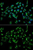 Anti-CDKN3 antibody used in Immunocytochemistry/ Immunofluorescence (ICC/IF). GTX55567