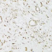 Anti-CIAPIN1 antibody used in IHC (Paraffin sections) (IHC-P). GTX55572