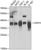 Anti-CNPY3 antibody used in Western Blot (WB). GTX55574