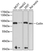 Anti-Coilin antibody used in Western Blot (WB). GTX55575