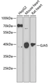 Anti-Connexin 40 antibody used in Western Blot (WB). GTX55576