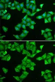 Anti-COX5A antibody used in Immunocytochemistry/ Immunofluorescence (ICC/IF). GTX55578