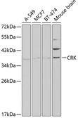 Anti-CRK antibody used in Western Blot (WB). GTX55580