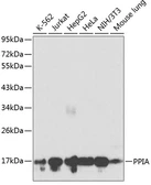 Anti-Cyclophilin A antibody used in Western Blot (WB). GTX55581