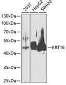 Anti-Cytokeratin 16 antibody used in Western Blot (WB). GTX55584