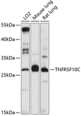 Anti-DcR1 antibody used in Western Blot (WB). GTX55586