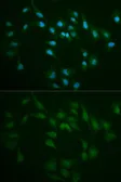 Anti-DNA ligase I antibody used in Immunocytochemistry/ Immunofluorescence (ICC/IF). GTX55590