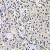 Anti-DNA-PKcs antibody used in IHC (Paraffin sections) (IHC-P). GTX55593
