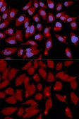 Anti-DNMT3A antibody used in Immunocytochemistry/ Immunofluorescence (ICC/IF). GTX55596