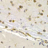Anti-EEF1D antibody used in IHC (Paraffin sections) (IHC-P). GTX55601