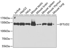 Anti-EFTUD2 antibody used in Western Blot (WB). GTX55602