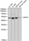 Anti-EPHX1 antibody used in Western Blot (WB). GTX55606