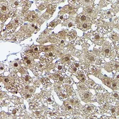 Anti-ERK5 antibody used in IHC (Paraffin sections) (IHC-P). GTX55608