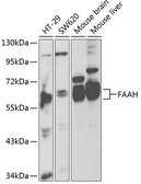 Anti-FAAH antibody used in Western Blot (WB). GTX55611