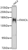 Anti-FANCA antibody used in Western Blot (WB). GTX55613
