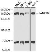 Anti-FANCD2 antibody used in Western Blot (WB). GTX55614