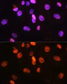 Anti-FANCD2 antibody used in Immunocytochemistry/ Immunofluorescence (ICC/IF). GTX55614