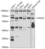 Anti-FANCG antibody used in Western Blot (WB). GTX55615