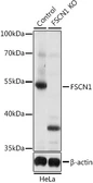 Anti-Fascin 1 antibody used in Western Blot (WB). GTX55616
