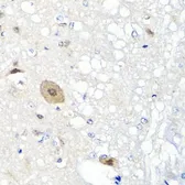 Anti-FGF13 antibody used in IHC (Paraffin sections) (IHC-P). GTX55620