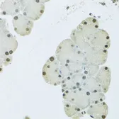 Anti-FIP1L1 antibody used in IHC (Paraffin sections) (IHC-P). GTX55623