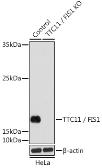 Anti-FIS1 antibody used in Western Blot (WB). GTX55624