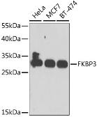 Anti-FKBP25 antibody used in Western Blot (WB). GTX55625