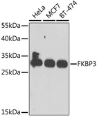 Anti-FKBP25 antibody used in Western Blot (WB). GTX55625