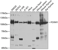 Anti-FOXM1 antibody used in Western Blot (WB). GTX55627