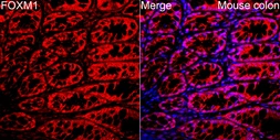 Anti-FOXM1 antibody used in IHC (Paraffin sections) (IHC-P). GTX55627
