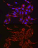 Anti-Furin antibody used in Immunocytochemistry/ Immunofluorescence (ICC/IF). GTX55628