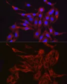 Anti-Furin antibody used in Immunocytochemistry/ Immunofluorescence (ICC/IF). GTX55628