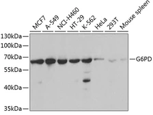 Anti-G6PD antibody used in Western Blot (WB). GTX55630