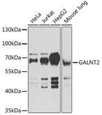 Anti-GALNT2 antibody used in Western Blot (WB). GTX55634