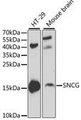 Anti-gamma Synuclein antibody used in Western Blot (WB). GTX55635
