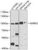 Anti-GRK3 antibody used in Western Blot (WB). GTX55648