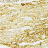 Anti-Grp75 antibody used in IHC (Paraffin sections) (IHC-P). GTX55649