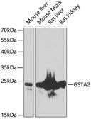 Anti-GSTA2 antibody used in Western Blot (WB). GTX55651