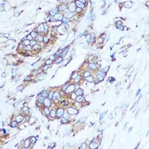 Anti-GSTT1 antibody used in IHC (Paraffin sections) (IHC-P). GTX55652