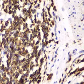 Anti-HCLS1 antibody used in IHC (Paraffin sections) (IHC-P). GTX55654